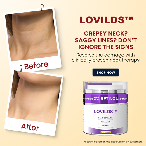 LOVILDS™Premium Neck Firming Cream - Retinol & Collagen Treatment for Wrinkles, Sagging Skin & Double Chin Reduction (50ml)