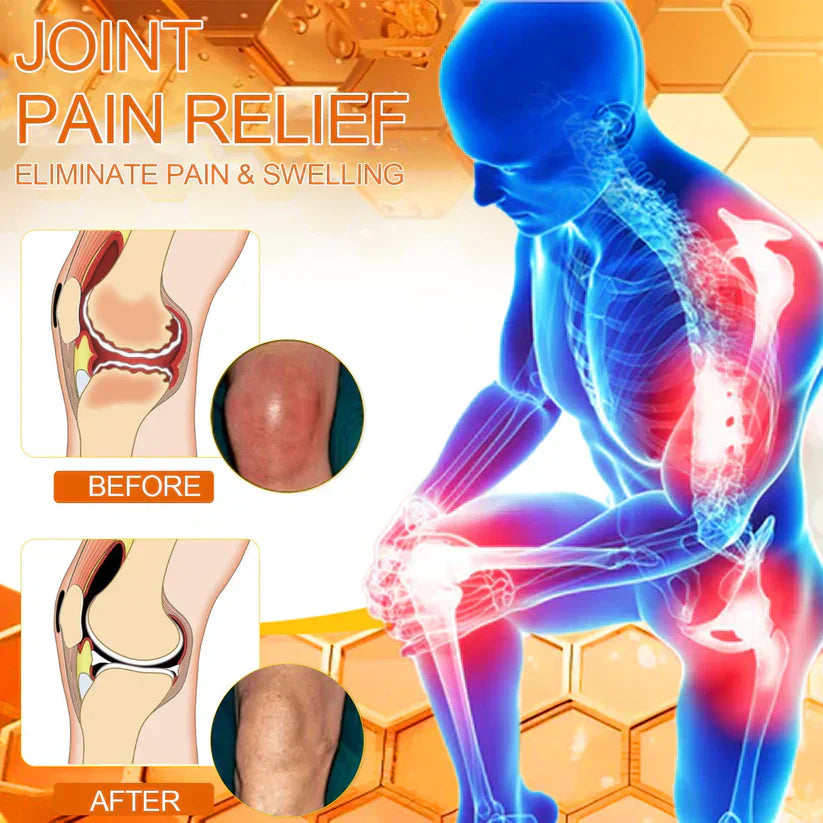 Bee poison Pain Relief and Bone Care Ointment