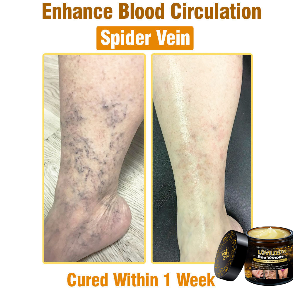 LOVILDS™ Bee Venom Cream — Trusted by Millions for Healthy, Glowing Skin