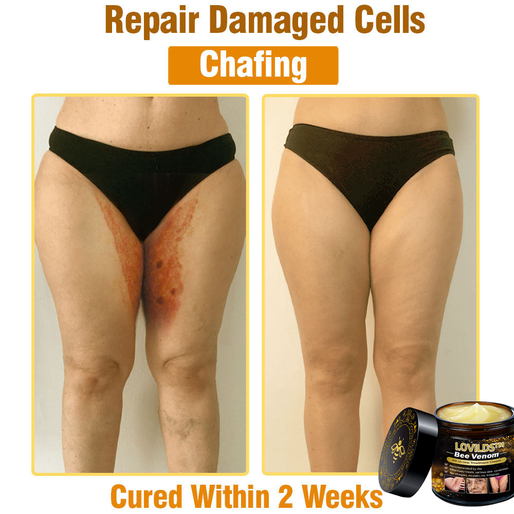 LOVILDS™ Bee Venom Cream — Trusted by Millions for Healthy, Glowing Skin