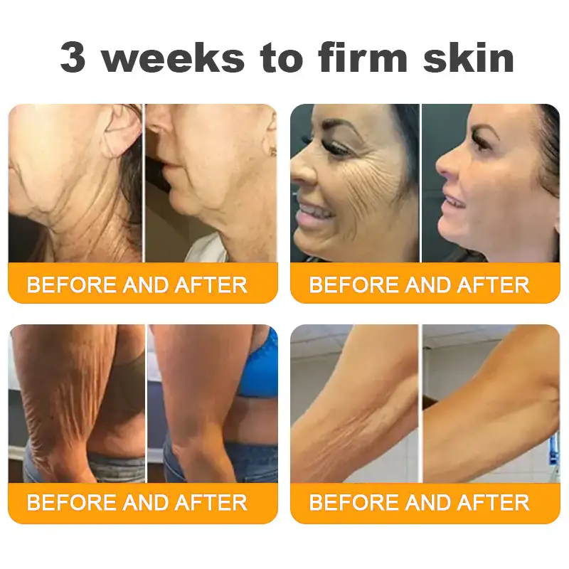 Made and Shipped from USA ✨ Qooes® Bee Venom Skin Restoration Cream ⏰ LAST DAY 80% OFF