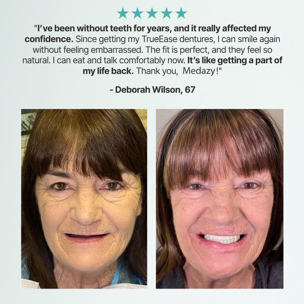 Medazy PrecisionFit Dentures ✨ – Custom Comfort, Natural Bite & Perfect Smile! 🦷