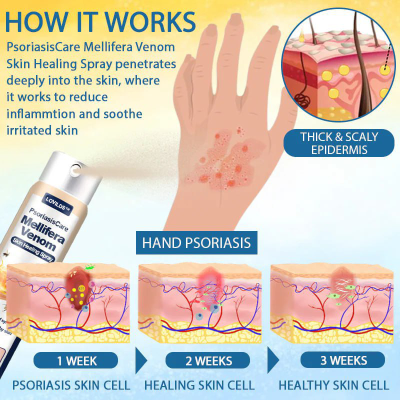 LOVILDS® Psoriasis Care Mellifera Venom Skin Healing Spray🔥