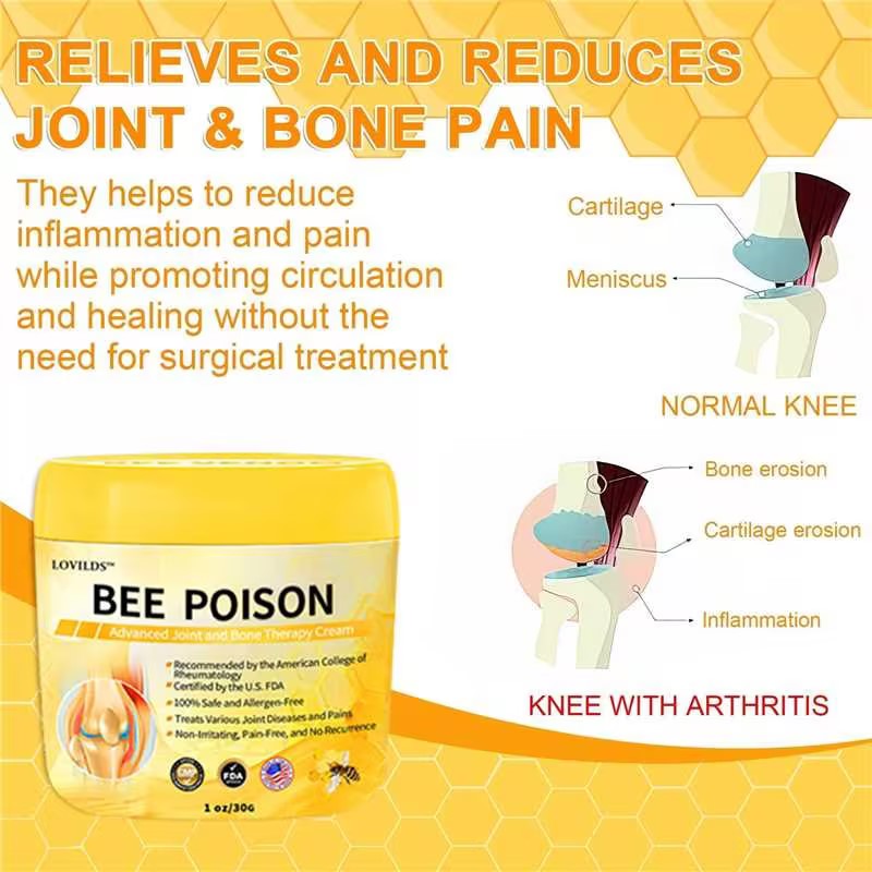 🐝🐝𝐋𝐎𝐕𝐈𝐋𝐃𝐒™ 𝐁𝐞𝐞 Poison 𝐀𝐝𝐯𝐚𝐧𝐜𝐞𝐝 𝐉𝐨𝐢𝐧𝐭 𝐚𝐧𝐝 𝐁𝐨𝐧𝐞 𝐓𝐡𝐞𝐫𝐚𝐩𝐲 𝐂𝐫𝐞𝐚𝐦 (𝐍𝐞𝐰 𝐙𝐞𝐚𝐥𝐚𝐧𝐝 𝐁𝐞𝐞 𝐄𝐱𝐭𝐫𝐚𝐜𝐭 - 𝐒𝐩𝐞𝐜𝐢𝐚𝐥𝐢𝐳𝐞𝐬 𝐢𝐧 𝐎𝐫𝐭𝐡𝐨𝐩𝐞𝐝𝐢𝐜 𝐃𝐢𝐬𝐞𝐚𝐬𝐞𝐬 𝐚𝐧𝐝 𝐀𝐫𝐭𝐡𝐫𝐢𝐭𝐢𝐬 𝐏𝐚𝐢𝐧)