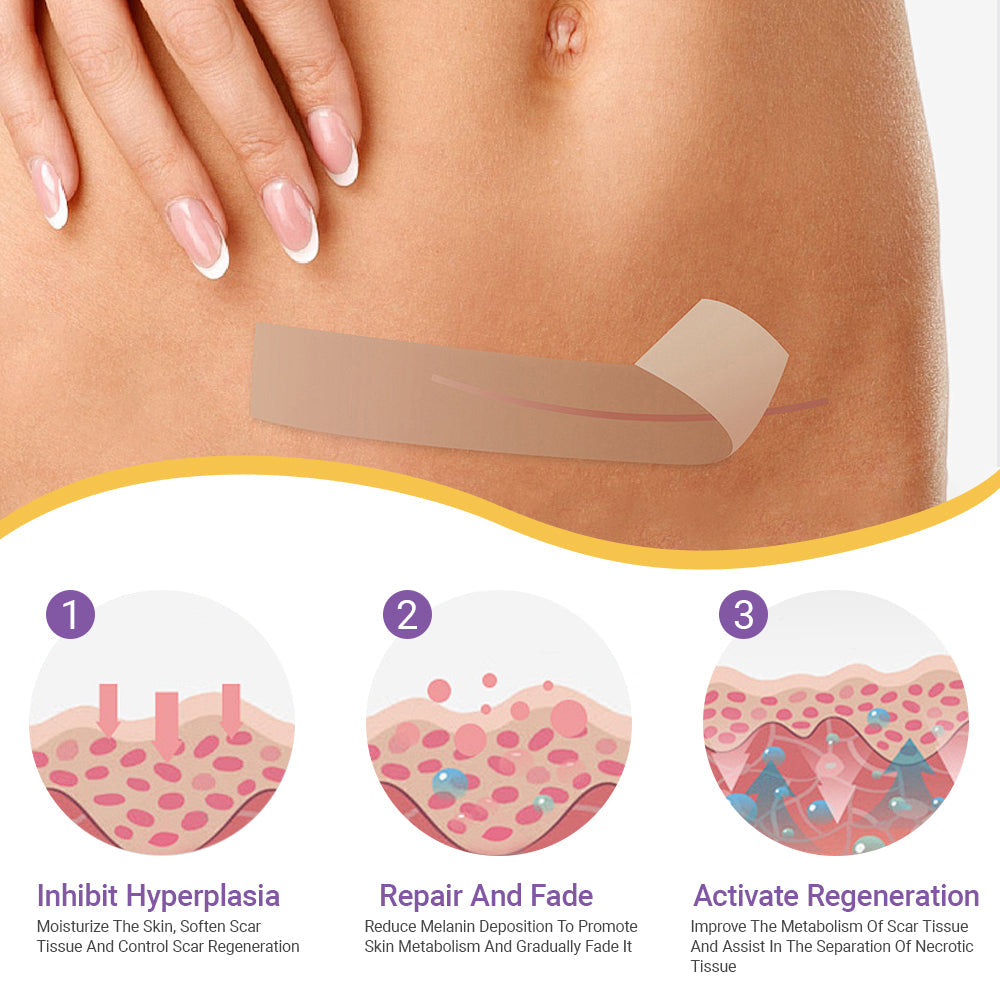 ✅Official Store |LOVILDS® Hyaluronic Acid Nano Microneedle Repair Tape🏉❤️
