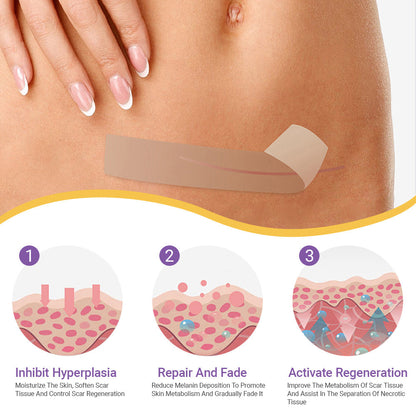 ✅Official Store |LOVILDS® Hyaluronic Acid Nano Microneedle Repair Tape🏉❤️