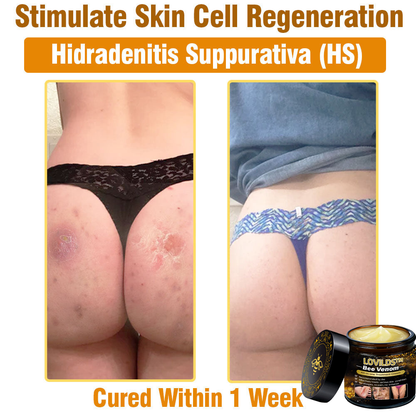 LOVILDS™ Bee Venom Cream — Trusted by Millions for Healthy, Glowing Skin