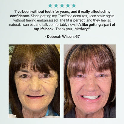 Medazy PrecisionFit Dentures ✨ – Custom Comfort, Natural Bite & Perfect Smile! 🦷